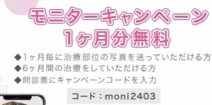 東京ミレニアルクリニック無料モニターキャンペーンコード