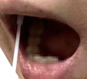 ジーンライフダイエット 唾液摂取方法