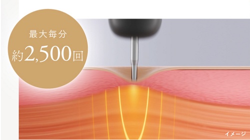 NIPLUX(ニップラックス) BEGUN効果